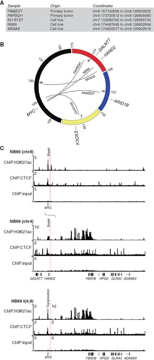 Figure 4. Elevated MYC expression is concomitant with segmental 8q chromosomal translocations. A, List of MYC-expressing primary tumors and cell lines with the genomic coordinates of each chromosomal translocation. B, Circos plot illustrating the observed chromosomal translocations associated with the MYC gene on chromosome 8q24 in patient tumors and MYC-expressing neuroblastoma cell lines. Gray lines indicate the translocation of separate chromosomes observed in the indicated patient tumors and cell lines. C, ChIP-seq for H3K27ac shown with input control data for the chromosomal regions harboring the MYC and HAND2 gene loci in NB69 cells. H3K27ac modifications are indicative of superenhancers that mediate high levels of gene expression. Dotted lines indicate the breakpoints where translocation was detected by WGS. Merged tracks for H3K27ac ChIP-seq with input control demonstrate that the superenhancer formerly driving expression of HAND2 and FBXO8 is repositioned by the t(4;8) proximal to the MYC gene locus in NB69 cells.