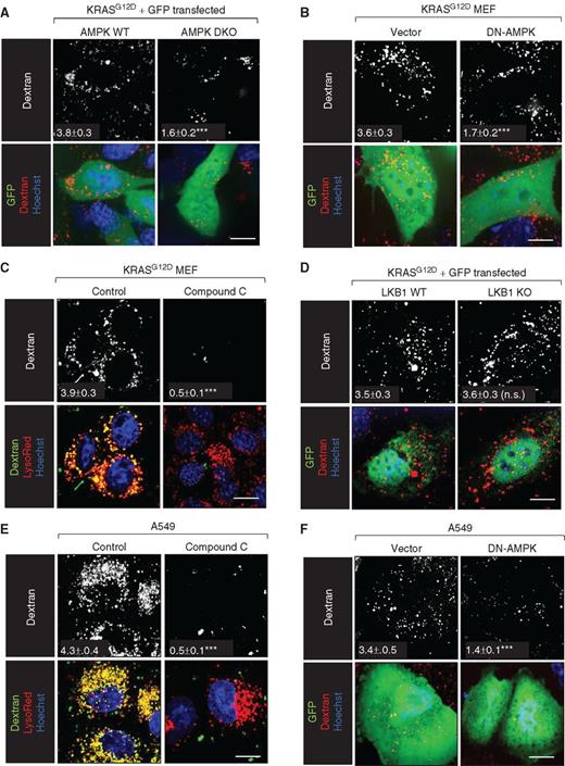 Figure 3. AMPK activity is necessary for KRAS-driven macropinocytosis. A, Dextran uptake in GFP-positive AMPK WT or DKO MEFs 48 hours after cotransfection with KRASG12D and GFP plasmids. B, Dextran uptake in GFP-positive KRASG12D MEFs 72 hours after transfection with plasmids expressing GFP or DN-AMPK-IRES-GFP. C, Dextran uptake in KRASG12D MEFs ± compound C (10 μmol/L). D, As in A but in LKB1 WT or KO MEFs. E, Dextran uptake in A549 (LKB1−/−, KRASG12S) ± compound C (10 μmol/L). F, As in B but in A549 cells. Scale bars, 20 μm. All experiments were performed in complete medium. Dextran index ± SEM indicated in white with statistics relative to untreated, vector, or WT control; ≥ 25 cells were examined. Using a paired, two-tailed t test, ***, P ≤ 0.001; n.s., not significant.