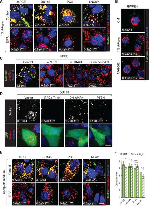 Figure 4. PTEN-deficient prostate cancer cells exhibit constitutive macropinocytosis. A, Dextran uptake in prostate cancer in 1% AA/gluc ± EIPA (50–75 μmol/L). B, Dextran uptake in RWPE-1 cells in complete medium (CM) or 1% AA/gluc ± A769662 (50 μmol/L). C, Dextran uptake in mPCE cells ± PTEN reconstitution or a 1-hour pretreatment with the pan-PI3Ki ZSTK474 (200 nmol/L) or Compound C (10 μmol/L). D, Dextran uptake in GFP-positive DU145 cells 48 hours after transfection with plasmids expressing GFP or GFP and RAC1T17N, DN-AMPK, or WT PTEN. E and F, Dextran uptake in prostate cancer cell lines in CM ± EIPA (50–75 μmol/L), compared with results in 1% AA/gluc in F. G, Dextran index in prostate cancer cells incubated with dextran for 5 minutes in CM ± A769662 (50 μmol/L). All panels except A and part of B were conducted in complete medium. Scale bars, 20 μm. Dextran index in white; means ± SEM shown with statistics relative to control, CM, or vector; ≥25 cells were examined. Using a paired two-tailed t test, *, P ≤ 0.05; **, P ≤ 0.01; ***, P ≤ 0.001; n.s., not significant. See also Supplementary Fig. S6.