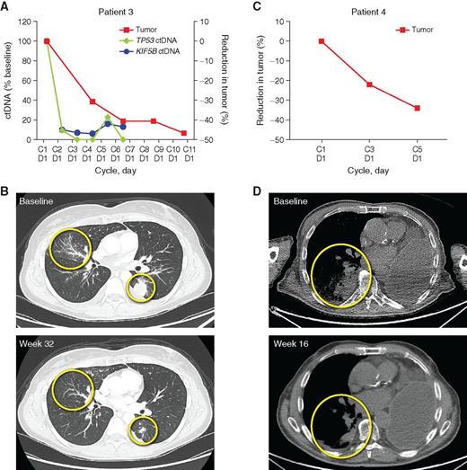 Figure 6. Partial response achieved with BLU-667 in a metastatic KIF5B–RET NSCLC tumor. A, Tumor and KIF5B–RET and TP53 ctDNA reduction over the course of treatment with 200 mg once-daily BLU-667 demonstrates rapid response to BLU-667. B, CT scan illustrates tumor (circled) at baseline (top) and after 32 weeks of BLU-667 treatment (bottom). C, Tumor reduction over 4 cycles of treatment with 300 mg BLU-667. ctDNA not available for this patient. D, CT scan of the patient's tumor (circled) at baseline (top) and after 16 weeks of BLU-667 treatment (bottom). C, cycle number; D, day.