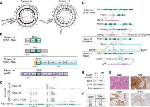 Figure 2. NRG1 fusions. A, Circos plots of patients 14 and 15 showing DNA copy-number profiles and gene fusions predicted from transcriptome sequencing data. B, Protein domains predicted to be retained in the chimeric proteins. TM, transmembrane; C, cytoplasmic; EGF, epidermal growth factor-like; Ig, immunoglobulin-like; Hep, heparin-binding; Zn, zinc-binding; Kun, Kunitz; Col, collagen-binding; Cdh, cadherin. C, Coverage of NRG1 exons in transcriptome sequencing data. Fusion breakpoints are indicated by red dashed lines. D, Fusion partners and retained exons. E, H6c7 cells transduced to stably express either GFP only (Co) or ATP1B1–NRG1 fusion including (ANi) or lacking (AN) the intergenic sequence. Western blotting demonstrated afatinib-sensitive AKT and ERK phosphorylation in H6c7 cells transduced with the AN fusion. F, In vivo transformation assays demonstrated tumor formation after 17 weeks in NSG mice transplanted with AN-transduced cells, but not Co- or ANi-transduced mice. G, IHC of an AN-induced xenograft tumor revealed constitutive ERK and AKT phosphorylation. H&E, hematoxylin and eosin.