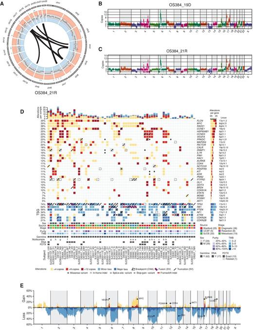 Figure 1. Genomic analysis of osteosarcoma (OS) and identification of recurrent SCNAs in primary tumors. A, Circos plot for indicated sample. CN gain and losses (outermost circle; red and blue, respectively), loss of heterozygosity (intermediate circle), and structural alterations (inner arcs) are shown. B and C, Genome-wide SCNA plot for diagnostic and resection samples from the same patient. D, Analysis of alterations across a cohort of 63 samples from 54 patients in actionable and druggable genes. CN gain was classified as >4 copies, >8 copies, or >12 copies. Actionable genes where at least 2 patients have gains of >8 copies were included in the top plot. Selected genes of interest (AKT1 and FOXM1) were also included. Losses for selected tumor-suppressor genes (TSG) were calculated and classified as <1.2 copies (minor) or <0.8 copies (major) and included in the bottom plot. SV truncations, gene fusions, and SNVs were calculated and included as indicated. Genes contained in segments with different CN states are annotated as a breakpoint (CNA). Top bar plot summarizes the CN gain/loss per sample. Right bar plot summarizes the CN gain/loss for a gene. Each column represents a single sample. Numbers to the left indicate percentage of alteration across patients (samples derived from the same patient were aggregated). In the top plot, only gains were included in the alteration percentages. For tumor suppressors, losses, SV, and SNVs were included. Purity estimates for each sample were calculated, and all CN gains/losses were adjusted accordingly. The genome-wide tumor mutation burden (TMB) was also calculated for each sample with a matched germline (number of variants across the genome per megabase). Samples collected from the same patient are labeled with the same letter in the “multisample” row. E, Combined genome-wide SCNA across all patients in the cohort (samples derived from multiple samples were combined). Percentages are of patients with gains and/or losses in 10 kb bins tiled across the genome. Gain/loss calculated and annotated as above. The loci of selected genes of interest are shown.