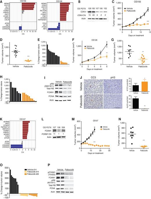 Figure 4. CDK4- and FOXM1-amplified PDTXs respond to palbociclib treatment. A, Rank order of SCNA gains and losses in PDTX OS156 (left) and OS128 (right). B, Western blot of PDTXs with various CNs of CDK4. C, CDK4-amplified PDTX (OS156) growth curve treated with palbociclib compared with vehicle. D, Individual tumor volume at end of study in C,***, P < 0.0001. Error bars, SEM. E, Waterfall plot of individual tumors in C. F, PDTX (OS128) growth curve treated with palbociclib compared with vehicle. G, Individual tumor volume at end of study in F, **, P = 0.0035. Error bars, SEM. H, Waterfall plots of individual tumors in F. I, Western blot of short-term treated tumors from OS156 with palbociclib for 3 days. J, IHC of PDTX OS156 short-term treated tumors for CC3 and quantitation (per 10X FOV), *, P = 0.02, and at end of study for pH3 and quantitation (per 10X FOV), **, P = 0.002. Error bars, SD. Scale bar, 100 μm. K, Rank-ordered gene list of SCNA gains and losses for PDTX OS107. L, Western blot of PDTXs with various CNs of FOXM1. M, OS107 PDTX growth curve treated with palbociclib, tumor volume at treatment day 14, ***, P < 0.0001. N, Tumor volume at day 14 of treatment in M, ***, P < 0.0001. Error bars, SEM. O, Waterfall plot at 14 and 28 days of treatment from M. P, Western blot of PDTX OS107 short-term treated tumors with palbociclib compared with vehicle.