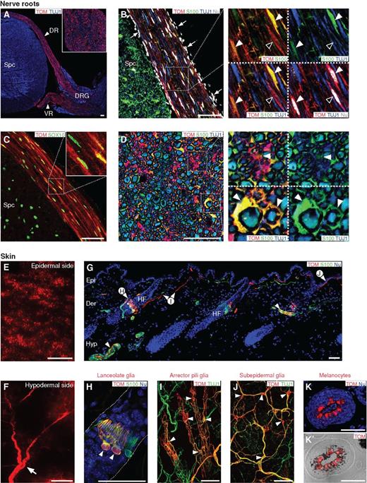 Figure 1. Tracing of Prss56-positive BC cell derivatives in the adult PNS. A–D, Analysis of BC cell derivatives (TOM+) in the adult nerve roots of Prss56Cre, R26tdTom mice. A, Transverse section through the cervical spinal cord reveals the presence of numerous TOM+ cells along the dorsal and ventral nerve roots and in the DRG. The inset shows a transverse section through the dorsal root. B–D, Most nerve root TOM+ cells express S100 (B, D) and SOX10 (C) and correspond to SCs (full arrowheads in B and D). Note the presence TOM+/S100− endoneurial cells (open arrowheads in B) and TOM− perineurial fibroblasts (see also Supplementary Fig. S1C). Spc, spinal cord; DR, dorsal root; VR, ventral root; DRG, dorsal root ganglion; Nu, nuclear labeling. E–K′, Analysis of BC cell derivatives in the dorsal skin of adult Prss56Cre, R26tdTom mice. E and F, Dorsal (epidermal) and ventral (hypodermal) views of the back skin showing direct TOM fluorescence. Note the patch-like distribution of TOM+ cells. G, Transverse section of the skin immunolabeled with TOM and an SC marker S100. TOM+ cells are associated with dermal and hypodermal innervation (arrowheads in G and arrow in F, respectively) and correspond to nmSCs, including lanceolate glia (G, H), arrector pili glia (G, I), and subepidermal glia (G, J). I and J are dorsal views of whole-mount skin colabeled with TOM and axonal marker TUJ1. K and K′, TOM+ pigmented melanocytes within a hair follicle. TOM staining merged with a bright field image (K′) reveals melanin granules (dark pigment). Epi, epidermis; der, dermis; hyp, hypodermis; HF, hair follicle. Scale bars, 50 μm (A–D, G–K′), 1 mm (E, F).