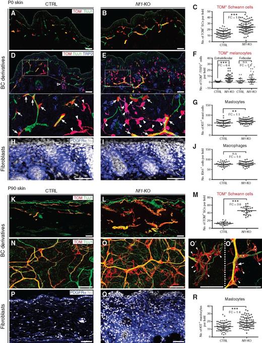 Figure 4. Nf1 loss of function in BC cells promotes proliferation of dermal Schwann cell and melanocyte lineages. A–J, Comparison of control and Nf1-KO newborn skin immunolabeled for TOM, TUJ1 (nerves), TRP2 (melanocytes; A, B, D, E), and PDGFRα (fibroblasts; H and I) show expansion of traced BC derivatives, including SCs (nerve-associated TOM+/TRP2− cells; D and E, arrows) and melanocytes (nerve-free TOM+/TRP2+ cells; D and E, arrowheads), but not of dermal fibroblasts in the mutant dermis. Insets in D and E show higher magnifications of the indicated area. C, F, G, and J, Quantification of traced SCs (C), traced follicular and extrafollicular melanocytes (F), nontraced KIT+ mastocytes (G), and IBA1+ macrophages (J) in control versus Nf1-KO P0 skin. K–O″, Comparison of 3-month-old control and Nf1-KO–mutant skin immunolabeled for TOM and TUJ1 (K and L) reveals further expansion and morphologic abnormalities of the traced SC population in the mutant. M, Quantification of traced SCs in the control and Nf1-KO dermis. N and O, Dorsal views of clarified skin at the level of subepidermal nerve plexus. O′ and O′′ show higher magnifications of mutant subepidermal SCs. Note numerous cytoplasmic extensions (arrowheads) and an SC soma (arrow) detached from the adjacent axon bundle. Asterisks indicate SC somas. P and Q, Staining of PDGFRα+ dermal fibroblasts reveal a dramatic expansion of this population in the mutant dermis. R, Quantification of nontraced KIT+ mastocytes in the control and Nf1-KO dermis. Data are represented as mean values ± SD. Each data point corresponds to a number of cells per field of view. Fold change (FC) differences are given for each comparison. Scale bars, 50 μm. **, P < 0.01; ***, P < 0.001.