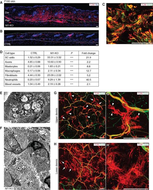 Figure 5. Six-month-old Nf1-KO–mutant skin contains numerous micro-cNFs. A and B, Transverse sections through Nf1-KO–mutant (A) and control (B) skin reveal local accumulations of TOM+ cells in the mutant dermis. The dotted lines indicate upper tissue limits and the boundaries between the dermis (Der) and the hypodermis (Hyp). C, High-magnification view of the mutant dermis shows abnormal morphology of TOM+/S100+ SCs. D, Quantification of the relative abundance of different cell types in micro-cNFs and control skin. The data are represented as mean values measured per 0.026 μm2 ± SEM (***, P < 0.0001). Fold-change differences are given for each comparison. SC unit refers to SC soma or fragment of SC cytoplasm (>2 μm). E and F, Electron micrographs showing typical nonmyelinated nerve fibers in the control dermis (E) and a disrupted Remak bundle in a micro-cNF (F). Arrow indicates the perikaryon of a mutant SC devoid of axonal contact, and arrowheads indicate abnormal cytoplasmic extensions, often enwrapping pairs or single axons separated by collagenous extracellular matrix. a, axon; Nu, cell nucleus. G–H′, Global (G, H) and higher-magnification (G′, H′) views of the mutant skin in the upper and lower dermis showing aggregates of TOM+ SCs with abnormal morphologies. Most SCs extend abnormal cytoplasmic protrusions (arrowheads) or appear to be detached from the axons (arrows). Scale bars, 50 μm (A–C, G–H′), 1 μm (E, F).