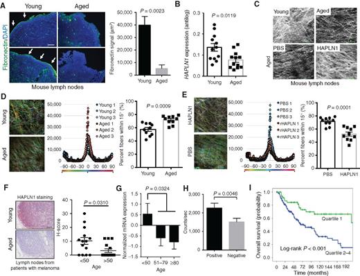 Figure 4. Effects of HAPLN1 on lymph node integrity. A, Representative two-photon microscopy of pericapsular collagen structure of inguinal lymph node in young or aged C57BL/6 mice, and corresponding quantification. B, HAPLN1 mRNA expression as measured by RT-PCR. C, Representative two-photon microscopy of pericapsular collagen structure of inguinal lymph node in aged C57BL/6 mice treated with rHAPLN1 (100 ng twice weekly) or PBS. D, Quantification of young and aged lymphatic pericapsular ECM fiber orientation by collagen fluorescence. Each point in the corresponding dot plot represent the mean number of fibers oriented at each angle (paired bars, SEM). The fiber distribution was determined by calculating the percentage of fibers arranged in parallel for each acquired region (±90° of the mode angle); the percentage of fibers within 15° of the mode was compared between study arms (two-tailed unpaired t test, P = 0.0009). E, Quantification of lymphatic pericapsular ECM fiber orientation by collagen fluorescence after HAPLN1 treatment. F, Representative HAPLN1 IHC of sentinel lymph node specimens of patients with clinically node-negative melanoma (scale bar, 100 μm). Each sample was assigned an H-score that included the relative signal intensity and area of staining (n = 30; two-tailed unpaired t test, P = 0.0310). G, Age-stratified TCGA analysis of HAPLN1 mRNA expression in regional lymphatic tissue of patients with primary melanoma (n = 192; two-tailed unpaired t test, P = 0.0324). H, Geiger counts of patients with melanoma following sentinel lymph node biopsy with 99mTc sulfur colloid injection, stratified by HAPLN1 positivity by IHC staining (n = 86; two-tailed unpaired t test, P = 0.0046). I, Kaplan–Meier survival function of human patients with nonmetastatic melanoma in the TCGA database, stratified by quartiles of regional lymph node HAPLN1 mRNA (n = 192; log-rank P < 0.001).