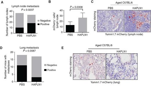 Figure 5. In vivo effects of HAPLN1 on routes of metastatic dissemination. A, mCherry-labeled Yumm1.7 cells were injected into aged C57BL/6 mice (n = 18/arm) and the draining lymph nodes were treated with HAPLN1 (100 ng) or PBS. Tumor metastases in the draining lymphatics were identified by IHC staining (χ2 P = 0.0237). B, Lymphatic tumor burden was quantified (two-tailed unpaired t test, P = 0.0308). C, Representative IHC of mCherry-positivemetastasis (red) in draining lymphatics. D, Tumor metastases in the lung in the identical mouse cohort were identified by IHC staining (χ2 P = 0.0087). E, Representative IHC of mCherry-positive metastasis (red) in the lungs.