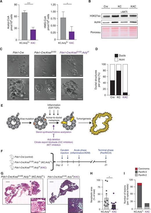 Figure 4. Acly deficiency impairs ADM and tumor formation. In vivo and ex vivo experiments were performed using Pdx1-Cre (Cre), Pdx1-Cre;KrasG12D (KC), Pdx1-Cre;KrasG12D;Aclyf/+ (KC;Aclyf/+), or Pdx1-Cre;KrasG12D;Aclyf/f (KAC) mice. A, LC-MS quantification of acetyl-CoA (left) and HMG-CoA (right) in isolated acinar cells (n = 3 mice for KC;Aclyf/+; n = 4 for KAC). Bars, mean ± SD (***, P < 0.001; *, P < 0.05). B, Western blotting for acetylated histones of ex vivo acinar cells isolated from 8-week-old mice of the indicated genotypes, ± AKTi (selective inhibitor VIII, 10 μmol/L). Ponceau staining of acid-extracted histones is shown as a loading control. Representative of 3 independent biological repeats. C, Acinar cell organoids were embedded in collagen and ADM induced with rTGFα (100 ng/mL). Images were acquired at day 5; representative images are shown (n = 3 independent repeat, each group). Scale bars, 20 μm. D, Day 5 organoids were scored as ductal-like (black) or acinar-like (white) in a blinded manner, according to morphology. Seventy-five images over 3 independent experiments were evaluated. E, Cartoon illustrating factors that promote ADM or restrict ADM. Kras-mutant acinar cells (denoted by orange nuclei) undergo ADM and become locked into a more undifferentiated morphology (cells highlighted in yellow), which eventually proliferate and evolve in carcinogenic lesions. F, Cerulein-injected mice were sacrificed at either day 3 (inflammatory phase; n = 3, each group) or day 21 (terminal stage; n = 12 KC;Aclyf/+, n = 10 KAC). G, H&E staining of day 21 pancreata. Representative images of whole tissue sections. Scale bars, 1 mm. PanIN-containing areas magnified in distinct panels. H, Total neoplastic area quantified. Each lesion's area and whole organ surface were measured in ImageJ. Lesions' areas were summed and denoted as “neoplastic area.” Percentage of neoplastic area over total pancreas surface is shown. Each dot represents an animal. Error bars, mean ± SD (*, P < 0.05). I, Histopathologic characterization. Ten high-power optical fields per mouse section were blindly analyzed by a veterinary pathologist. For all panels, columns show mean ± SD (*, P < 0.05; **, P < 0.01; ***, P < 0.001).