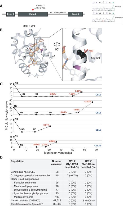 Figure 1. Detection of the BCL2 Gly101Val mutation in patients with progressive CLL on venetoclax (VEN), but not in venetoclax-naïve patients. A, Genomic structure of the BCL2 locus indicating the position of the point mutation (left). Right, Sanger sequencing traces from DNA extracted from CLL3 before venetoclax treatment (top) and at the time of CLL-type progression (bottom) showing acquisition of NM_000633.2; c.302G>T, p.(Gly101Val). B, Ribbon representation of α-helices 1–8 that form the BCL2 binding groove, indicating the location of Gly101 (red) and Phe104 (purple) on the α2 helix. Gly101 is highlighted in the black sphere representation, and a representative valine side chain at this position is indicated by the red stick. The structure is that of a venetoclax analogue (orange) bound to BCL2 (PDB: 4MAN) (1). C, Time course of CLL response and subsequent reemergence during venetoclax therapy. The CLL burden was measured by multiparameter flow cytometry in serial bone marrow aspirates from 4 patients from the initiation of venetoclax until the clinical diagnosis of progressive disease. Each achieved a clinical response: complete remission for CLL2, 3, and 12 and partial remission for CLL5. The VAF of BCL2 Gly101Val in bone marrow samples measured by droplet digital PCR is overlaid. ND, not detected. BCL2 Gly101Val VAF is indicated in red. The mutation was first detected in bone marrow after 33, 42, 31, and 19 months on venetoclax for patients CLL2, CLL3, CLL5, and CLL12, respectively. D, Summary of the incidence of BCL2 Gly101Val mutation and BCL2 Phe104Leu mutation in CLL (venetoclax-treated, venetoclax-naïve) and other B-cell malignancies in this study; and in publicly available cancer databases or a general population. ahttps://cancer.sanger.ac.uk/cosmic (accessed August 25, 2018). bhttp://gnomad.broadinstitute.org/ (accessed August 25, 2018).