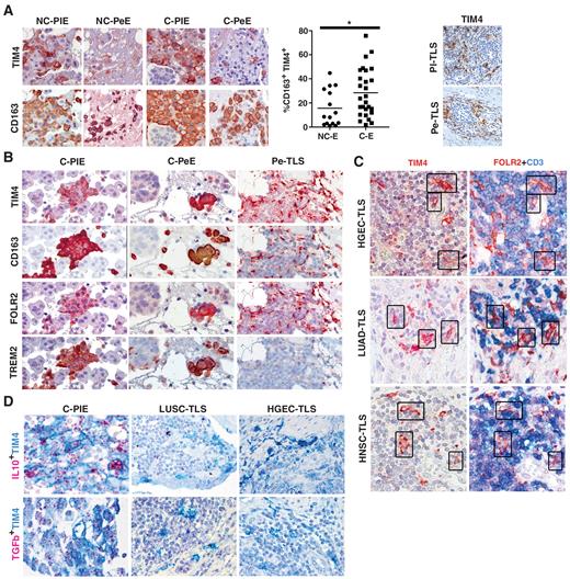 A Population of TIM4+FOLR2+ Macrophages Localized in Tertiary Lymphoid ...