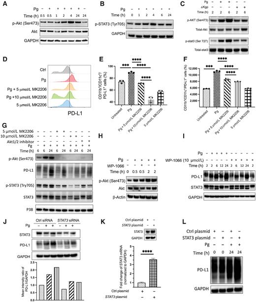 Figure 3. P. gingivalis infection activates Akt–STAT3 signaling and thereby promotes the expression of PD-L1 on DCs. A–C, Western blots showing the dynamic phosphorylation of Akt and STAT3 in P. gingivalis– or ΔKgp-infected Flt3l-DCs. D-F, Flow cytometry analysis showing PD-L1 expression in P. gingivalis–challenged Flt3l-DCs with/without the Akt inhibitor MK2206. Each symbol represents an experimental replicate, and data are shown as mean ± SE. Statistical significance was determined by one-way ANOVA with Tukey multiple comparisons test. ***, P < 0.001; ****, P < 0.0001. G–L, Flt3l-DCs were pretreated with various Akt inhibitors, Akti (targeting Akt1/2), MK2206 (5 μmol/L), or WP-1066 (10 μmol/L) for 2 hours or transfected with specific stat3 siRNA or a plasmid encoding stat3 with a scramble siRNA and vehicle plasmid as controls. Western blotting was performed to assess (G) PD-L1 expression and STAT3 phosphorylation after inhibition of Akt; (H) phosphorylation of Akt in P. gingivalis–stimulated DCs after inhibition of STAT3; and (I and J) P. gingivalis induced DC-PD-L1 after WP-1066 and siRNA-mediated STAT3 inhibition or (K and L) overexpression of STAT3 in DCs (K and L). The transfection efficiency was estimated by the expression of total STAT3 (J and K). For the fold change of STAT3 mRNA, data represent three independent experiments. Error bars represent the mean ± SE. Statistical significance was determined by a two-tailed unpaired t test. ****, P < 0.0001. GAPDH or total P38 were probed as a loading control. All the blots and flow cytometry assays are representative of 3 independent experiments.