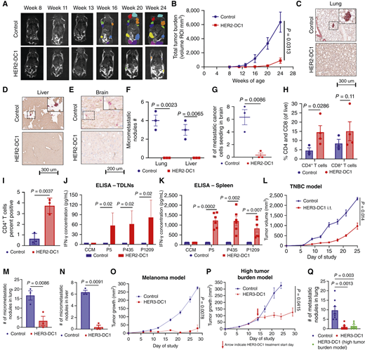 Intratumoral activation of antitumor CD4Th1 cells inhibits spontaneous metastasis. A, MRI images of BALB-neuT mice treated with or without intramammary gland HER2-DC1 (n = 6/group). B, Total tumor burden was recorded by MRI for experimental BALB-neuT mice (n = 6/group). C–E, IHC HER2 and CYT 8/18 double staining for the detection of micrometastases in lung (C), liver (D), and brain (E) sections from BALB-neuT mice treated with or without HER2-DC1 (n = 3/group). F, Quantification of spontaneous micrometastases in the lung and liver of experimental BALB-neuT mice (n = 3/group). G, Quantification of metastatic cancer cells seeding in brain of experimental BALB-neuT mice (n = 3/group). H, Infiltration of CD4T and CD8T cells in mammary gland of HER2-DC1–treated BALB-neuT mice and control analyzed by flow cytometry (n = 3–4/group). I, Frequency of CD4 T cells infiltration in the mammary gland of HER2-DC1–treated BALB-neuT mice and control determined by IHC (n = 3/group). J, IFN-γ secretion after coculturing TDLNs (from experimental BALB-neuT mice) with or without HER2-DC1 individually pulsed with p5, p435, and p1209 for 72 hours by automated ELISA (n = 2/group). K, IFN-γ secretion after restimulating splenocytes of experimental mice with rat HER2/neu peptides p5, p435, and p1209 individually and analyzed by automated ELISA (n = 4–6/group). L, Tumor growth curves of control and intratumoral HER3-DC1–treated BALB/c mice bearing 4T1 TNBC tumors (n = 9–10/group). M and N, IHC HER3 and Pan-cytokeratin (Pan-CYT) double staining for the detection and quantification of metastases in lung (M) and liver (N) sections from 4T1 TNBC spontaneous metastasis model (n = 3/group). O, Tumor growth curves of control and intratumoral HER3-DC1–treated C57BL/6 mice bearing B16F10 melanoma with spontaneous metastasis (n = 10/group). P, Tumor growth curves of B16-F10 high tumor burden spontaneous metastasis–bearing mice treated with or without intratumoral HER3-DC1 (n = 7–10/group). Q, Hematoxylin and eosin staining for the detection and quantification of spontaneous metastatic nodules in lungs from experimental B16F10 melanoma spontaneous metastasis model (O and P; n = 5–8/group). All data are presented as mean ± SEM. P values were calculated with one- or two-tailed Student t test. i.t., intratumoral delivery; ROI, region of interest.