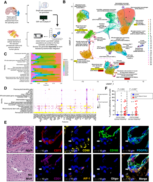 PDGFRβ+ PVSCs are a cellular component of MVP. A, Experimental schematic of human tissue analyses. scRNA-seq was performed on 16 human glioma specimens. Libraries of CD45−CD105+ and CD45+ cells were generated separately and then bioinformatically integrated. DSP and multiplex IF were performed on representative patient samples. B, Uniform Manifold Approximation and Projection (UMAP) visualization and annotation of cell clusters. Two MSC populations were identified, one of which clustered with fibroblastic cells and pericytes. MSC markers (NT5E, ENG, THY1, and PDGFRA) are highlighted in yellow, whereas PDGFRB is highlighted in red. C, Stacked bar plot showing the proportion of cells contributed by individual patient tumors for each cell population in (B). D, Dot plot of the signature genes of PVSCs derived from the top 50 differentially expressed markers in PVSCs compared with all other cells. Note: PDGFRB is one of the most specific and sensitive standalone markers. E, Representative H&E and multiplex IF images of the perivascular niche in gliomas with (n = 3) and without (n = 4) MVP. Classic MSC markers (CD73, CD90, and CD105), a pan-microglia/monocyte/macrophage marker (AIF1), an endothelial cell marker (CD31), a glioma stem cell/oligodendrocyte/oligodendrocyte precursor marker (OLIG2), as well as PDGFRβ, a marker derived from (A), were used to characterize the perivascular niche. The morphology of MVP corresponded mostly with PDGFRβ, not CD31. PDGFRβ was present but not expanded morphologically in gliomas without MVP (Supplementary Fig. S5). An arrow indicates a PDGFRβ+CD73+CD90+CD105+ cell. A PDGFRβ−CD73+CD90+CD105+ cell is shown in Supplementary Fig. S5. F, Automated quantitative analysis of classical MSC markers (CD73, CD90, and CD105) and PDGFRβ in regions with MVP, regions without MVP, and regions adjacent to MVP that were normal-appearing was performed. Two populations of MSCs (CD73+CD90+CD105+) can be found in the perivascular niche, but only those also expressing PDGFRβ are associated with MVP. **, P = 0.009; unpaired t-test with the Welch correction. cDC2, classic type 2 dendritic cells; Tnaive/CM, naïve and central memory T cells; Treg, regulatory T cells.
