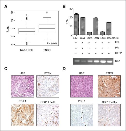 Figure 1. PD-L1 is expressed in breast cancer. A, analysis of TCGA data demonstrated higher PD-L1 mRNA expression in breast tissue specimens from patients with TNBC (n = 120) in contrast with patients with non-TNBC (n = 716). Data are mean ± SD of PD-L1 mRNA expression. Analysis was done using a t test. Log2 expression of PD-L1 is shown on the y-axis. B, PD-L1 mRNA expression (mean ± SD) in breast cancer patient tumors was measured using RT-PCR. RNA was extracted from breast cancer cells that were isolated from tumors using LCM (1–5). Cytokeratin 7 (CK7) was used as a marker of breast cancer to confirm the source of the extracted RNA. MDA-MB-231 was used as a positive control for PD-L1. C, representative TNBC patient tumor tissues showing loss of PTEN expression and high PD-L1 expression in tumor cells, and a significant CD8+ T-cell infiltrate in contrast with another TNBC patient tissue (D), which shows high PTEN expression in breast tumor cells, no PD-L1 expression in tumor cells, minimal PD-L1 expression in associated inflammatory cells, and minimal intratumoral CD8+ T-cell infiltrate. Magnification, ×100. H&E, hematoxylin and eosin.