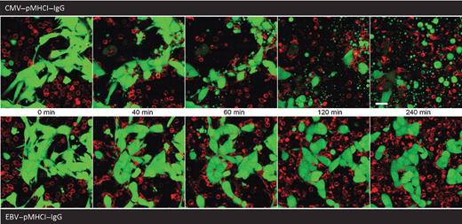 Figure 3. Fluorescence microscopy analysis of CMV–pp65-specific CD8+ T cell–mediated killing of tumor cells using pMHCI–IgGs. Time-lapse confocal microscopy of CMV–pp65-specific CD8+ T cell–mediated killing of MCSP+ tumor cells (Colo38) incubated with 15 nmol/L of CMV–pMHCI–IgG (top) or EBV–pMHCI–IgG (bottom) as control. T cells are stained in red (PKH-26; Sigma) and tumor cells in green (CMFDA; LifeTechnologies). Constructs are indicated at top and bottom of the rows, respectively. The effector-to-target-cell ratio was 3:1; time in minutes is indicated between the rows (0, 40, 60, 120, and 240 minutes from left to right).