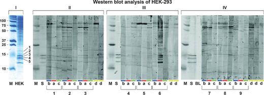 Figure 3. Western blot analysis of endogenous survivin in HEK-293 cell lysate. I, SDS-PAGE of HEK-293 cell lysate. Molecular weight control (M), HEK-293 cell lysate (HEK). Protein bands of interest (1–5) in the 16-kDa region were excised from the gel for MS analysis. MS/MS database search identified survivin in bands 2 and 3. Proteins that showed intense bands were identified as ribosomal proteins. II–IV, Western blot analysis of HEK-293 cell lysate. Molecular weight control (M). Staining of endogenous survivin in HEK-293 cell lysate (15–16 kDa) with 1:2,500 diluted rabbit anti-survivin (S) and staining with blank control (BL). Antibody response to antigens in HEK-293 cell lysate in sera from 7 nonsmoking control subjects (d, yellow box) and 9 longitudinally collected sample sets (1–9), each set consisting of one case analyzed before diagnosis (b, dark blue box) and after diagnosis of NSCLC (a, red box) and one smoking-habit control matched to this case (c, green box). Immunodetected proteins at 16 kDa were observed for all samples, including smoking-habit control subjects and nonsmoking control subjects. No anti-survivin reactivity was detected in any of the patient sera.