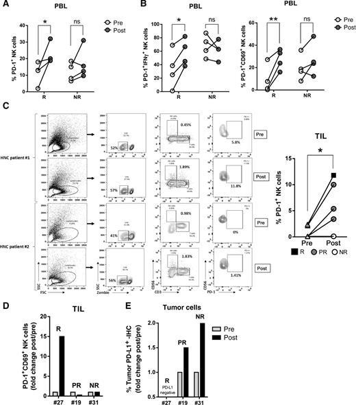 Figure 4. In vivo cetuximab responders have higher PD-1+ NK cells in PBLs and in TILs only when tumor cells expressed little to no PD-L1. A, Frequency of PBL PD-1+ NK cells in vivo. PBLs were isolated from stage III/IVA HNC tumor specimens pre- and post-cetuximab single-agent treatment (clinical trial UPCI #08-013) and PD-1 expression on NK cells was determined by flow cytometry and matched with response status (n = 4 responders, n = 4 nonresponders. Wilcoxon test; ns, P > 0.05; *, P < 0.05; **, P < 0.001). B, PD-1+ IFNγ+ and PD-1+CD69+ NK cells were determined in the same cohort of patients (Wilcoxon test; ns, P > 0.05; *, P < 0.05; **, P < 0.001). C, TILs were isolated from tumor specimens pre- and post-cetuximab single-agent treatment and PD-1 expression on NK cells was determined by flow cytometry. Left, representative gating strategy; right, summary of 6 paired pre–post specimens (R, responder; PR, partial responder; NR, nonresponder; Wilcoxon test; *, P < 0.01). D, Frequency of PD-1+CD69+ NK cells in TIL post-cetuximab treatment and correlation with clinical response. Fold change of % PD-1+CD69+ NK cells POST/PRE cetuximab was calculated and matched with response status. R, responder; PR, partial responder; NR, nonresponder. E, PD-L1 expression (IHC) in tumor specimens in the same cohort shown in D. Fold change of PD-L1+ tumor cells POST/PRE cetuximab was determined and correlated with response status. R, responder; PR, partial responder; NR, nonresponder.