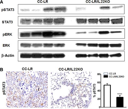 Figure 4. IL22 activates the STAT3 and ERK pathways in Kras-mutant lung tumors. A, Western blot of pSTAT3 and pERK protein expression in whole lung lysates from CC-LR and CC-LR/IL-22KO mice at the age of 14 weeks. B, Representative photomicrograph (20× magnification) and quantitative analysis of immunohistochemically stained slides for pSTAT3 in lung tissue of CC-LR and CC-LR/IL22KO mice at 14 weeks of age (N = 3 per group). Data represent mean ± SEM; unpaired t test, ****, P < 0.0001.