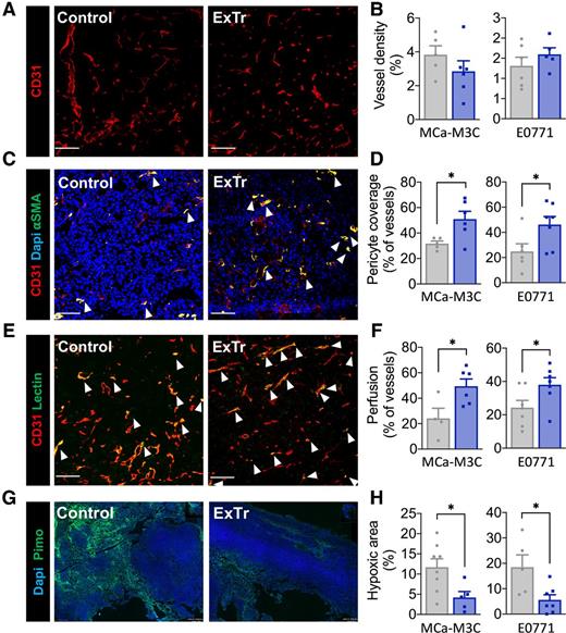 Figure 2. ExTr normalizes tumor blood vessels and reduces hypoxia. Immunofluorescence quantification was done in tumor sections to measure vessel normalization and hypoxia. Representative images from E0771 model (A, C, E, and G) and corresponding quantitative data (B, D, F, and H). Left (gray) and right (blue) bars indicate control and ExTr, respectively. A and B, Vessel density, indicated by fractional area (stained for CD31+). C and D, Vessel normalization, characterized by the fraction of vessels with pericyte coverage (CD31+αSMA+). E and F, Perfused vessels, expressed as the fraction of vessels (CD31+) also positive for lectin. G and H, Fractional hypoxic area. Red indicates vessels; green indicates pericytes (αSMA; C), perfused vessels (lectin; E), or hypoxic area [pimonidazole (Pimo); G]; and blue indicates nucleus (DAPI; C and G). White arrowheads highlight costaining. Scale bar, 100 μm. n = 4–8 (MCa-M3C) and n = 5–7 (E0771). Statistical differences between groups by unpaired Student t test. Data presented as mean ± SEM. *, P < 0.05.