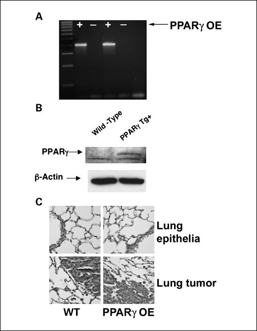 Fig. 3. Characterization of PPARγ OE transgenic mice. A, agarose gel electrophoresis of the PCR product for the PPARγ transgene (400-bp band) indicating transgene-positive mice. B, Western blot of isolated type II cells from PPARγ OE transgenic mice (PPARγ Tg+) and WT littermates confirms increased expression of PPARγ (50 kDa) in the overexpressing mice. C, representative hematoxylin-stained lung tissue samples from WT and PPARγ transgenic positive (PPARγ OE) mice. Specimens show that PPARγ OE mouse lungs display no anatomic differences and the tumors that develop are similar to those in WT mice (magnification, ×40). Tumors from the animals exposed to urethane also show no differences.