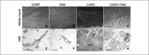 Fig. 1. Whole mounts (A-D; ×20), and H&E sections (E-H, ×100) of the mammary gland. Controls (CONT) and tamoxifen-treated (TAM) animals showed normal mammary histology (A-B, E-F). Carcinogen treatment (CARC) caused preneoplasia and neoplasia (C and G), and this effect was blocked by carcinogen + tamoxifen (CARC + TAM; D and H). Secreting mammary glands were observed in CARC + TAM rats. Bar, 5 mm (A-D), 200 μm (E-H).