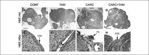 Fig. 2. H&E sections of the ovary. Bar, 600 μm (A-D), 50 μm (E-H and inset). CONT, controls; TAM, tamoxifen-treated rats; CARC, E2/DMBA–treated rats; OSE, ovarian surface epithelia; Pa, papilloma; IC, inclusion cyst.