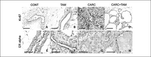 Fig. 3. Ki-67 and ERα immunostaining in the mammary gland. Mammary epithelial proliferation (% Ki-67) was increased above controls in CARC animals (A and C; P < 0.05). Carcinogen + tamoxifen treatment reduced this elevation (C and D; P < 0.05). Tamoxifen alone did not affect percent Ki-67 compared with controls (A and B). Carcinogen treatment depleted ER expression in the mammary gland when compared with control and TAM-treated animals (E-G; P < 0.05). There was a trend for ERα expression to increase in response to tamoxifen treatment in CARC + TAM animals when compared with the CARC group; however, this difference was not significant (G and H; P = 0.063). Bar, 100 μm (A-D), 50 μm (E-H).