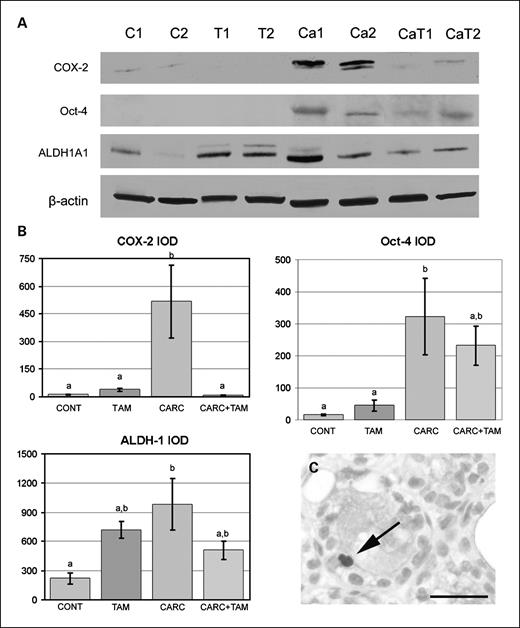 Fig. 4. COX-2, Oct-4, and ALDH-1 expression in the mammary gland. A, representative Western blots of mammary glands from rats treated with vehicle (C1 and C2), tamoxifen (T1 and T2), carcinogen (Ca1 and Ca2), and carcinogen + tamoxifen (CaT1 and CaT2). β-Actin was used as a loading control. B, quantitative analysis of Western blots showing that COX-2, Oct-4, and ALDH-1 levels (y axis, integrated absorbance (IOD) were elevated following carcinogen treatment (CARC) compared with controls (CONT). COX-2 expression was reduced by tamoxifen in the CARC + TAM group. Letters indicate significant differences among the treatment groups. C, cytoplasmic ALDH-1 immunostaining was observed in a few luminal epithelial cells in the mammary gland of CARC animals (arrow). No immunoreactivity was observed in control and TAM animals. Bar, 50 μm.