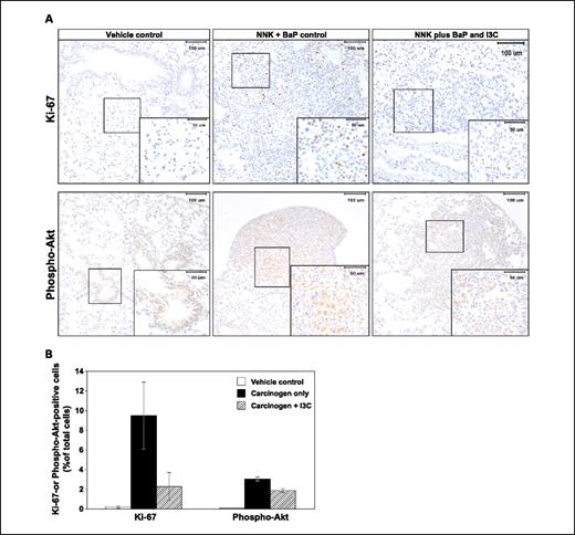 Fig. 4. Effect of I3C on cell proliferation and apoptosis. A, photomicrographs (×20) of Ki-67– and phospho-Akt–stained lung tissues from mice treated with vehicle control, NNK plus BaP, or the carcinogens and I3C. Lung tissues obtained from experiment 1 (groups 1, 7, and 9) were cut into 4-μm sections and stained with Ki-67 or phospho-Akt antibody and counterstained with hematoxylin. Images were captured with a camera attached to a Nikon Eclipse E800 microscope. B, quantitative assessment of Ki-67– and phospho-Akt–positive cells, representing the percentage of cells that stained positive for Ki-67 or phospho-Akt. The Ki-67 and phospho-Akt labeling index was calculated as described in Materials and Methods. Insets, higher magnification of selected areas. Columns, mean; bars, SD; *, P < 0.05. C, Western immunoblots of lung tissues. Whole lung tissues obtained from experiment 2 or normal lung tissues (group 9) and microdissected tumors (groups 1 and 7) from experiment 1 were prepared as described in Materials and Methods, and equal amounts of protein were loaded onto a 4% to 12% SDS-PAGE followed by immunoblot analysis and chemiluminescence detection. Equal loading of protein was confirmed by stripping the immunoblot and reprobing it for β-actin. *, P < 0.05. D, mean levels of phospho-Akt, Akt, phospho-BAD, PCNA, and cleaved PARP in lung tumor tissues relative to those in normal lung tissues. E, mean levels of phospho-Akt, Akt, phospho-BAD, PCNA, and cleaved PARP in lung tumor tissues from carcinogen and I3C-treated mice relative to those in tumors from mice treated with the carcinogens alone. *, P < 0.05.