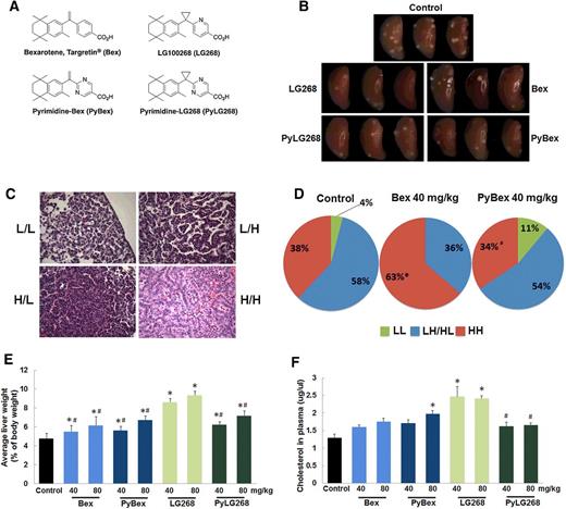 Figure 1. Evaluation of the efficacy and toxicity of rexinoids in preventing lung carcinogenesis in A/J mice. A, Structures of rexinoids used in these studies. PyBex and PyLG268 are new pyrimidine derivatives of bexarotene (Bex) and LG100268 (LG268), respectively. B, A/J mice were challenged with vinyl carbamate and then one week later, fed control diet or various rexinoids in diet for 16 weeks. Representative pictures of left lungs for each rexinoid at the end of the study. 10X magnification. C, Representative pictures of histopathology. Classification of tumor pathology was based on published histologic (first letter) and nuclear (second letter) criteria. L, low; H, high. D, Quantitation of histopathology. *, P < 0.05 versus control; #, P < 0.05 versus Bex. Liver weights (N = 12–24 mice/group; E) and plasma cholesterol levels (N = 6 mice/group; F) were lower in A/J mice fed PyLG268 compared with LG268. Liver weights at the end of the lung prevention study (16 weeks on diet) were normalized to body weight. Results shown as mean ± SEM (*, P < 0.05 vs. control; #, P < 0.05 vs. LG268 at the same concentration).