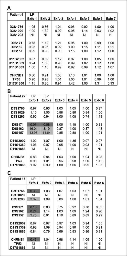 Fig. 1. Few typical examples of the noninvasive genetic AI assay on exfoliated cells of leukoplakia patients. Left, markers; top, samples analyzed. The ratios between the median of all samples and the sample analyzed for each markers are depicted. A, a patient without AI. B, a patient with AI in the leukoplakia lesion at all markers at 9p. C, the results from a patient with multiple chromosomal losses in the leukoplakia lesion. Gray, allelic imbalance (AI: ratio <0.5 or >2); LP, leukoplakia lesion; Exfo, exfoliated cells; NI, not informative).