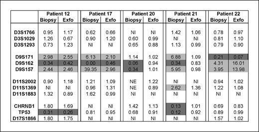 Fig. 3. Validation of the non invasive AI assay. Biopsies of the leukoplakia lesion were microdissected, analyzed by the same marker panel, and compared to the results of the exfoliated cells. Results from five patients which showed genetic alterations in the lesion. In general, the same genetic changes are seen in the exfoliated cell samples and the biopsies except for patients 20 and 21. Abbreviations are identical as indicated in the legend of Fig. 1.