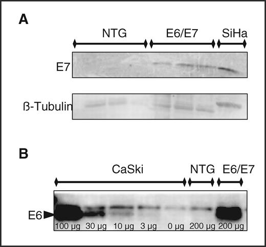 Fig. 1. HPV oncoproteins are expressed in the anus of K14E6/K14E7 mice. A, E7 Western blot analysis. Note that E7 protein is expressed in E6/E7 anal tissue at levels similar to that found in an HPV16-positive human cervical cancer cell line (SiHa) whereas none was found in nontransgenic (NTG) mice. B, E6 protein detected by Western blot analysis of protein lysates subjected to E6 pull-down assay using GST MAGI1-PDZ domain. In this experiment, the HPV16-positive cervical cancer cell line CaSki was used as a positive control.