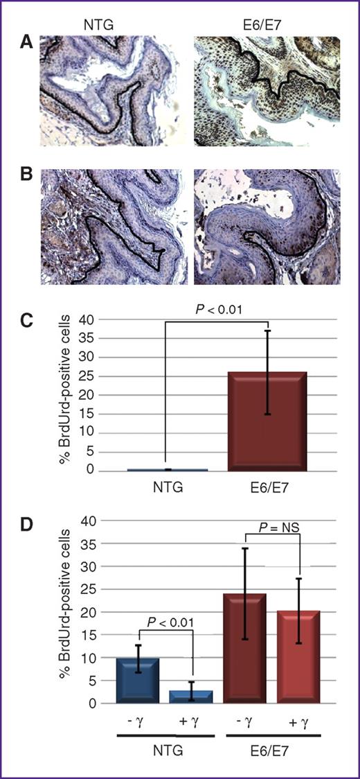 Fig. 2. Acute phenotypes of HPV16 E6/E7 transgenic mouse anal epithelium. A, MCM7-specific immunohistochemical staining of sections from the anus of nontransgenic (NTG) and K14E6/E7 transgenic mice. Note that in anal epithelium of E6/E7 mice, expression of MCM7, a biomarker for E7's inactivation of Rb, is strongly induced as compared with NTG mice. Brown nuclei indicate positive staining, which is expected along the basement membrane (outlined in black) in NTG mice whereas it is seen throughout the epithelium in E6/E7 mice. B, BrdUrd-specific immunohistochemical staining of sections from the anus of nontransgenic and K14E6/E7 transgenic mice. C, quantification of the percentage of suprabasal cells with BrdUrd-positive nuclei. D, response of anal epithelium to radiation-induced growth arrest. Shown is the quantification of the frequency of BrdUrd-positive basal cells in anal epithelia of nontransgenic and K14E6/E7 transgenic mice that were (+) or were not (−) treated with 12Gy (γ) external radiation.