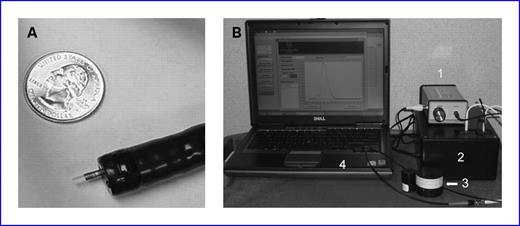 Fig. 1. Fiber-optic polarization-gated probe and clinical data collection system for real-time measurements in vivo. A, the 2.45-mm-diameter probe protruding from an accessory channel of an endoscope. B, photograph of the compact EIBS instrument with real-time capability for EIBS detection consisting of white-light LED light source (1), fiber-optic spectrometers (2), calibration stage (3), and laptop for real-time data display and analysis (4).