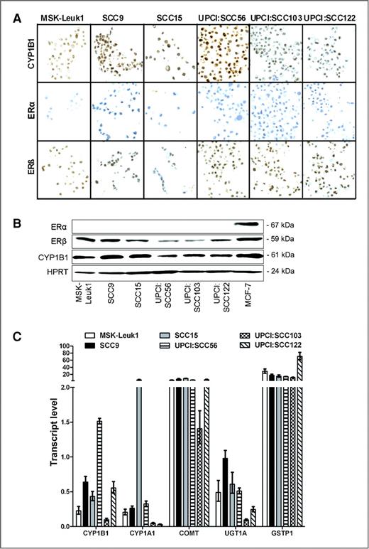 Figure 1. A, representative images of human premalignant (MSK-Leuk1) and malignant (SCC) head and neck cells stained with antibodies against CYP1B1, ERα, and ERβ. Secondary antibody alone was used as a negative control (not shown). Magnification 40×. B, detection of ERα, ERβ, and CYP1B1 in MSK-Leuk1, HNSCC, and MCF-7 cells by Western blot. C, expression of estrogen metabolism genes in cultured human premalignant and malignant head and neck cells. Values (2−ΔCt) represent transcript levels (±SD), normalized to the internal control (TFRC).