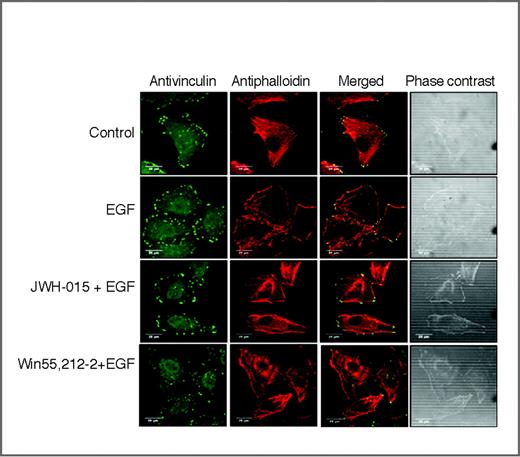 Figure 3. CB1 and CB2 receptor–mediated inhibition of focal adhesion formation. Confocal microscopic visualization of JWH-015- and Win55,212-2–pretreated A549 cells stimulated with EGF (100 ng/mL) for generation of focal adhesions (stained for vinculin, green) and stress fibers (stained for phalloidin, red). JWH-015 and Win55,212-2 inhibit formation of focal adhesions and stress fibers in NSCLC cells.