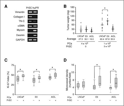 Figure 1. Effects of mixing tumor lines with PrSC on their tumorigenesis in vivo. A, gene expression of differentiation markers in PrSC. To confirm gene expression, we performed RT-PCR analysis. cDNA made from normal human prostate (huPR) poly A+ RNA was used as a positive control. The products were resolved on 1.6% agarose gels and visualized with ethidium bromide. B, comparison of tumor weights obtained by grafting animals with tumor lines alone or mixed with stroma. The tumor weights were measured 35 days after transplanting. *, P < 0.05 versus LNCaP + PrSC tumor. C, comparison of cell proliferation (Ki-67 labeling index) obtained by grafting animals with tumor lines alone or mixed with stroma. The Ki-67 positive cells were counted in 10 different areas at 400× magnification. *, P < 0.01 versus PCa + PrSC tumor. D, comparison of MVDs of tumors obtained by grafting animals with tumor lines alone or mixed with stroma. The mouse-specific CD31-positive vessels with lumens were counted in 10 different areas at 200× magnification. *, P < 0.01 versus PCa + PrSC tumor.
