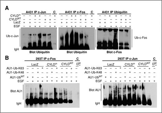 Figure 5. CYLD regulates K63 ubiquitination on c-Jun and c-Fos. A, IP for c-Jun, c-Fos, or ubiquitin followed by immunoblotting for ubiquitin or c-Fos. A431 cells stably expressing LacZ, CYLDWT, or CYLDm were treated with or without EGF for 1 hour. B, IP for c-Fos or c-Jun followed by immunoblotting for AU1. 293T cells were transfected for expression of LacZ, CYLDWT, or CYLDm along with AU1-tagged ubiquitinWT (UbiWT) or mutants including Ubi-K48 and Ubi-K63. Cells were then treated with or without EGF. IgH, IgG heavy chain; C represents control IP with protein A beads only.