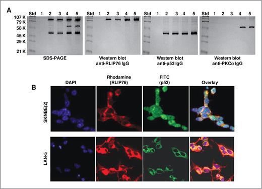 Figure 2. Interaction of RLIP76 with p53. Purified rec-RLIP76 and p53 proteins (10 μg each), in the absence/presence of equimolar concentration of PKCα and/or 1 mmol/L ATP were incubated for 30 minutes at 37°C and were cross-linked and immunoprecipitated as described in Materials and Methods. Cross-linked proteins were resuspended in 100 μL of SDS-PAGE sample buffer and analyzed by SDS-PAGE, followed by Western blots against anti-RLIP76 IgG, anti-p53 IgG, and anti-PKCα IgG. Lanes 1 to 5 shows the control with preimmune IgG (lane 1); immunoprecipitated RLIP76 and p53 (lane 2); RLIP76, p53 and 1 mmol/L ATP (lane 3); RLIP76, p53, and PKCα (lane 4); and RLIP76, p53, PKCα, and 1 mmol/L ATP (lane 5; A). Immunohistochemical localization of RLIP76 and p53 in p53-mutant (SKN-BE2) and p53-normal (LAN-5) neuroblastoma cells. Red, rhodamine for RLIP76; green, FITC for p53; yellow overlay indicating colocalization (B).
