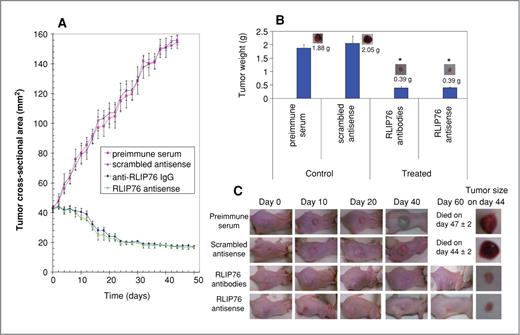 Figure 5. Effect of anti-RLIP76 IgG and RLIP76 antisense on the size of subcutaneously implanted human neuroblastoma cells in nude mice. Twenty 11-week-old nu/nu mice were divided into 4 groups of 5 animals (treated with preimmune serum, scrambled antisense DNA, anti-RLIP76 IgG, and RLIP76 antisense). All 20 animals were injected with 2 × 106 neuroblastoma cells (SMS-KCNR) suspensions in 100 μL of PBS, subcutaneously into 1 flank of each nu/nu nude mouse. Animals were examined daily for signs of tumor growth. When tumors reached a cross-sectional area of approximately 40 mm2 (∼30 days later), animals were randomized treatment groups as indicated in the figure. Treatment consisted of 200 μg of RLIP76 antibodies or antisense in 100 μL PBS, i.p. Control groups were treated with 200 μg/100 μL preimmune serum or scrambled antisense DNA. Tumors were measured in 2 dimensions by using calipers. Photographs of animals, taken at day 0, day 10, day 20, day 40, and day 60 after treatment, are shown for all groups. Tumor weights and photographs of tumors were also taken at day 44 after treatment. Tumor cross-sectional area in control and experimental groups (A and C); Tumor weight at day 44 (B and C). *, P < 0.001; n = 5.