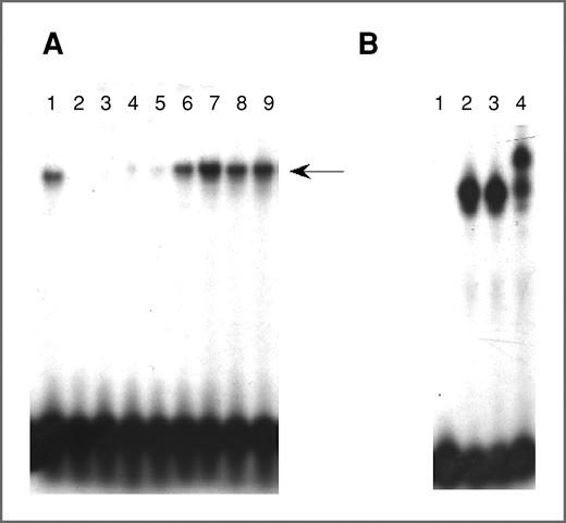 Figure 5. NF-κB is activated in the breast tissue of obese women. Ten micrograms of nuclear protein isolated from human breast tissue was incubated with a 32P-labeled oligonucleotide containing NF-κB binding sites. A, lane 1, standard; lanes 2 to 5, binding of nuclear protein from breast tissue of 4 women with CLS-B index of 0; lanes 6 to 9, binding of nuclear protein from breast tissue of 4 women with CLS-B index ranging from 0.2 to 1.0. B, lane 1, nuclear protein from a breast tissue sample with a CLS-B index of 1.0 incubated with a 32P-labeled oligonucleotide containing NF-κB binding sites and a 50× excess of cold probe; lanes 2 to 4, nuclear protein from the same sample incubated with normal IgG (lane 2), 1 μL (lane 3), or 2 μL (lane 4) of phospho-p65 antibody. In A and B, the protein–DNA complexes that formed were separated on a 4% polyacrylamide gel.