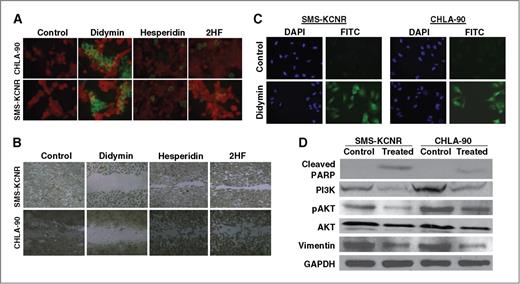 Figure 2. Proapoptotic and antimigratory effects of didymin in neuroblastoma. For TUNEL apoptosis assay, cells were grown on cover slips and treated with 50 μmol/L didymin for 24 hours. TUNEL assay was carried out using Promega Fluorescence Detection Kit and examined using Zeiss LSM 510 META laser scanning fluorescence microscope with filters 520 and more than 620 nm. Photographs taken at identical exposure at ×400 magnification are presented. Apoptotic cells showed green fluorescence (A). The in vitro migration assay shows that the didymin inhibits neuroblastoma cell migration in wound healing assay (B). For caspase activation detection, SMS-KCNR and CHLA-90 cells were plated on glass cover slip in tissue culture–treated 12-well plates and incubated with 50 μmol/L of didymin for 24 hours at 37°C. Apoptotic cells were detected by staining with 5 μmol/L caspase FITC–VAD–FMK (Promega) in situ marker for 30 minutes (C). Analysis of the effect of didymin on PARP cleavage, PI3K, and Akt activation by Western blot: The control and 50 μmol/L didymin-treated cells were lysed and analyzed by Western blot for PARP cleavage, PI3K (Y458/199), pAkt (S473), AKT, and vimentin by using specific antibodies. Membranes were stripped and reprobed for GAPDH as a loading control (D). DAPI, 4′,6-diamidino-2-phenylindole.