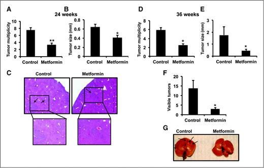 Figure 2. Metformin inhibits DEN-induced hepatocellular carcinogenesis. A, metformin reduces liver tumor multiplicity compared control treated mice at 24 weeks. B, reduced liver tumor size in mice treated with metformin at 24 weeks. C, representative H&E staining of paraffin-embedded liver sections. Sections also indicate no change in pathology of tumors. D, tumor number from livers of mice treated with control or metformin diet for 36 weeks. E, reduced liver tumor size in mice treated with metformin at 36 weeks. F, metformin reduces visible surface tumors after 36 weeks following DEN treatment. G, representative liver from control or metformin-treated mice after 36 weeks following DEN treatment. Mice were injected with DEN at 2 weeks of age and then placed on control or metformin chow diet after weaning. Mice were euthanized 24 or 36 weeks after DEN treatment. N = 7 mice per group ± SE, *, P < 0.05; **, P < 0.001.