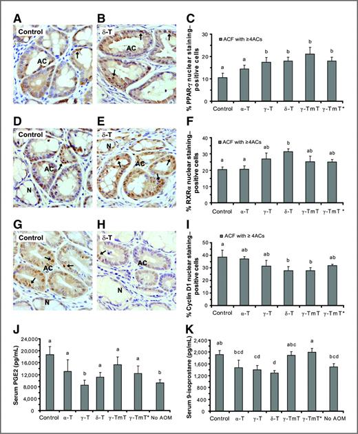 Figure 3. Effects of dietary tocopherols on the levels of PPAR-γ (A–C), RXRα (D–F), and cyclin D1 (G–I) in the colon, and the levels of PGE2 (J) and 8-isoprostane (K) in the serum. Examples of PPAR-γ, RXRα, and cyclin D1 nuclear staining (brown colored) in an ACF of the positive control group (A, D, and G), and in an ACF of the 0.2% δ-T group (B, E, and H) are shown. C, F, and I, effects of dietary tocopherol treatments (0.2% in the diet) on the levels of PPAR-γ (C), RXRα (F), and cyclin D1 (I) in the ACF (with 4 or more ACs), are shown as mean of the percentage of nuclear staining positive cells ± SE (n = 5). The effects of dietary tocopherols on the levels of PGE2 (J) and 8-isoprostane (K) in the serum were determined with EIA assay and shown as mean ± SE (n = 10 except for the negative control group for which n = 6). ANOVA-Duncan post hoc test was conducted. Different letters designate significant difference (P < 0.05). Arrows indicate nuclear staining of PPAR-γ in A and B, RXRα in D and E, and cyclin D1 in G and H. N, normal crypt.