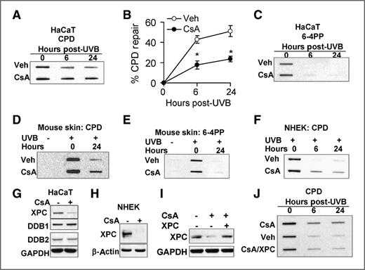 Figure 3. CsA impairs UVB-induced DNA damage repair through downregulating XPC. A, slot-blot analysis of CPD levels in vehicle (Veh)- or CsA-treated HaCaT cells at 0, 6, and 24 hours post-UVB (20 mJ/cm2). B, quantification of A as percentage of CPD repair. C, slot-blot analysis of 6-4PP levels in Veh- or CsA-treated HaCaT cells at 0, 6, and 24 hours post-UVB (20 mJ/cm2). D and E, slot-blot analysis of the CPD (D) and 6-4PP (E) levels in mouse skin treated with sham-irradiation or UVB irradiation (100 mJ/cm2) at 0 or 24 hours. F, slot-blot analysis of CPD levels in Veh- or CsA-treated NHEK cells at 0, 6, and 24 hours post-UVB (20 mJ/cm2). G, immunoblot analysis of XPC, DDB1, DDB2, and glyceraldehyde 3-phosphate dehydrogenase (GAPDH) in HaCaT cells treated with or without CsA (250 ng/mL). H, immunoblot analysis of XPC and GAPDH in NHEK cells treated with or without CsA (250 ng/mL). I, immunoblot analysis of XPC and GAPDH in vehicle or CsA–HaCaT cells transfected with empty vector (−) or XPC plasmid. J, slot-blot analysis of CPD levels of Veh-, CsA-, and CsA-treated/XPC-transfected HaCaT cells. *, P < 0.05, significant difference between vehicle and CsA-treated cells.