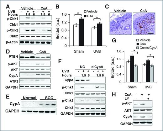 Figure 5. CsA disrupts UVB-induced checkpoint activation through AKT-dependent CypA upregulation. A, immunoblot analysis of p-Chk1 (serine 345), Chk1, p-Chk2 (Threonine 68), Chk2, and β-actin in vehicle- and CsA-treated HaCaT cells at 1.5 and 6 hours post-UVB (20 mJ/cm2). B, BrdUrd incorporation ELISA assay of vehicle- and CsA-treated HaCaT cells post-sham or -UVB irradiation. *, P < 0.05, significant difference between vehicle and CsA treatment. C, immunohistochemical analysis of Ki67-positive cells in vehicle and CsA-treated nontumor mouse skin irradiated with UVB 3 times a week for 25 weeks. Scale bar, 50 μm. D, immunoblot analysis of PTEN, p-AKT, AKT, CypA, ATF3, and GAPDH in vehicle- and CsA-treated mouse skin as in C. E, immunoblot analysis of CypA protein levels in normal human skin and SCC specimens. F, immunoblot analysis of CypA, p-Chk1, Chk1, p-Chk2, Chk2, and GAPDH in CsA-treated HaCaT cells transfected with negative control (NC) siRNA or siRNA targeting CypA (siCypA) at 1.5 or 6 hours post-UVB (20 mJ/cm2). G, BrdUrd incorporation ELISA assay of vehicle-treated, CsA-treated, CsA-treated/siCypA-transfected HaCaT cells post-sham or -UVB irradiation. *, P < 0.05, significant difference in CsA-treated HaCaT cells between NC and siCypA treatment. H, immunoblot analysis of p-AKT, AKT, CypA, and GAPDH in vehicle-, CsA-, and CsA/LY-treated HaCaT cells.