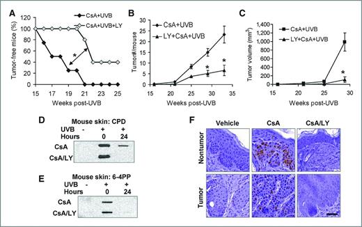 Figure 6. Inhibiting the AKT pathway prevents UVB/CsA-induced skin tumorigenesis. A, percent of tumor-free mice in CsA- and CsA/LY-treated mice at different times post-UVB irradiation 3 times a week for 25 weeks. *, P < 0.05, significant difference between indicated groups. B, tumor number (#) per mouse in CsA-treated and CsA/LY-treated mice at different times post-UVB irradiation 3 times a week for 25 weeks. *, P < 0.05, significant difference between CsA + UVB and CsA + UVB + LY groups. C, tumor volume (mm3) per mouse in CsA-treated and CsA/LY-treated mice at different times post-UVB irradiation 3 times a week for 25 weeks. *, P < 0.05, significant difference between CsA + UVB and CsA + UVB + LY groups. D and E, slot-blot analysis of CPD (D) and 6-4PP (E) levels in vehicle-, CsA-, and CsA/LY-treated mouse skin at 0 and 24 hours post-UVB (100 mJ/cm2) or sham-irradiation. F, immunohistochemical analysis of Ki67-positive cells in nontumor skin and tumor samples from vehicle-, CsA-, and CsA/LY-treated mice. Scale bar, 50 μm.