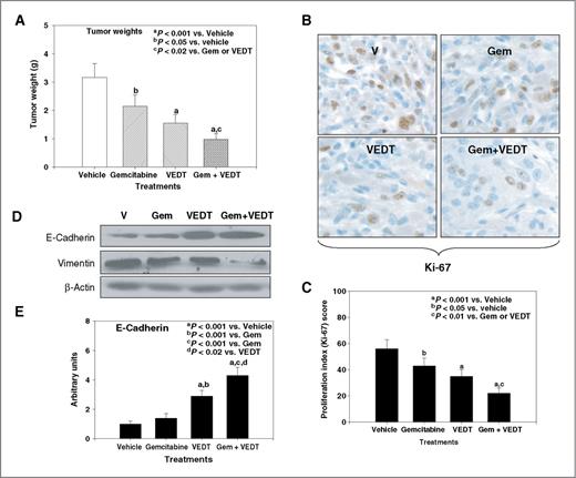 Figure 2. VEDT, alone and in combination with gemcitabine (Gem), inhibits tumor growth and EMT in KPC mice. A, mean pancreatic tumor weight changes in mice after drug treatment. Gemcitabine, VEDT, and gemcitabine + VEDT treatment significantly inhibited tumor growth by 32% (bP < 0.05), 51% (aP < 0.001), and 69% (aP < 0.001) compared to vehicle treatment. Bars indicate SE (n = 5). B, proliferation index (Ki-67) immunostaining in pancreatic tumor after drug treatment. C, semiquantitative analysis (histogram) shows that gemcitabine (bP < 0.05), VEDT (aP < 0.001), and gemcitabine + VEDT (aP < 0.001) treatment significantly inhibited tumor cell proliferation compared to vehicle treatment. Gemcitabine + VEDT significantly inhibited tumor cell proliferation (cP < 0.01) compared to gemcitabine or VEDT alone. Results are mean and SE (bars; n = 5). D, Western blotting of E-cadherin and vimentin in tumor tissues of KPC mice (n = 5). E-cadherin expression in the tumors was inversely related to vimentin expression, and EMT was profoundly inhibited when gemcitabine was combined with VEDT. E, semiquantitative analysis (histogram) shows that VEDT (aP < 0.001) and gemcitabine + VEDT (aP < 0.001) treatment significantly increased E-cadherin expression compared to vehicle treatment. Gemcitabine + VEDT significantly increased E-cadherin expression compared to gemcitabine (cP < 0.001) and VEDT (dP < 0.02). Results are mean and SE (bars; n = 5). All statistical analyses were conducted using ANOVA with Duncan test.